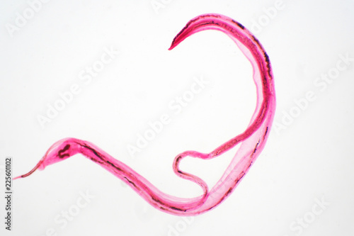 whipworm (Trichuris trichiura) is parasitic helminthic nematode (roundworm) photo