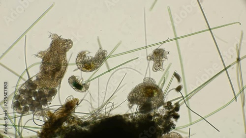 large family of water bears Tardigrada, female with eggs, males, cubs, under the microscope