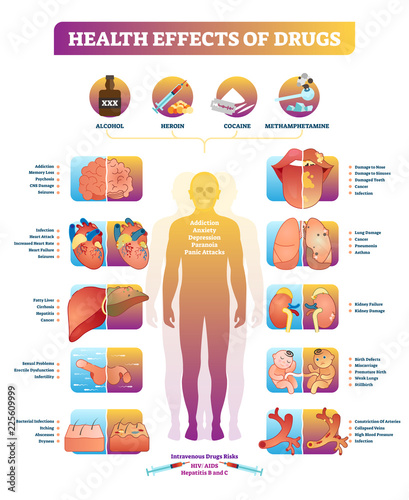 Health effects of illegal drugs vector illustration diagram. Disease set.