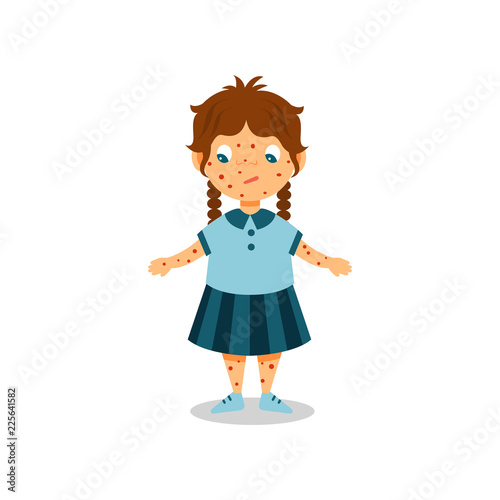 Girl with rash on her body and face, kid with symptoms of chickenpox vector Illustration on a white background