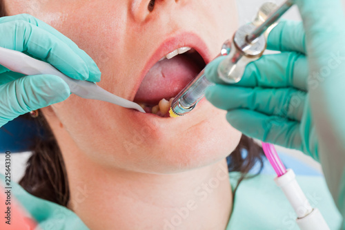 Local anesthesia before dental procedure