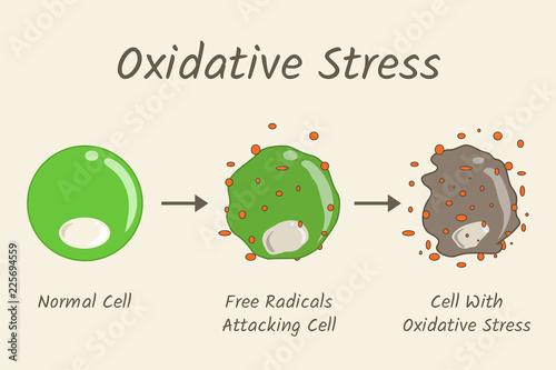 Oxidative Stress Diagram