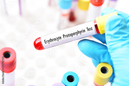 Blood sample tube for erythrocyte protoporphyrin test, diagnosis for anemia disease
 photo