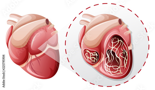 magnified heart worm concept