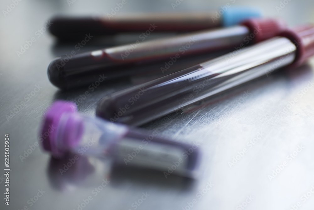 test tubes with blood on a medical table test tubes with blood on a medical table