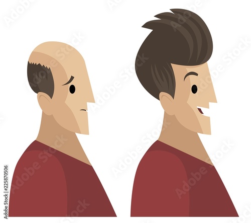 hair loss treatment