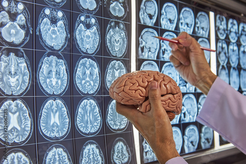 Quadro em tela A neurosurgeon holding brain model and pointing at brain MRI