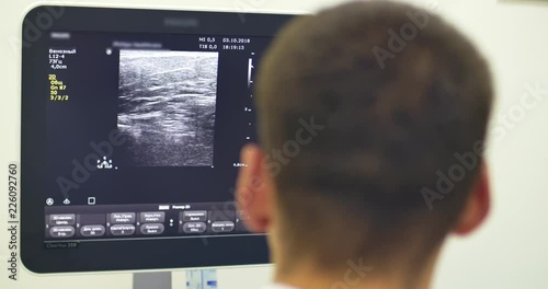 A doctor uses a modern sonogram to view vein in sclerotherapy procedure. An innovative method of varicose veins surgery, close-up