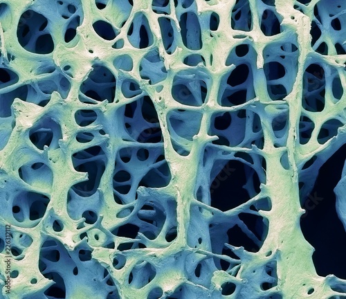 Bone tissue, SEM photo