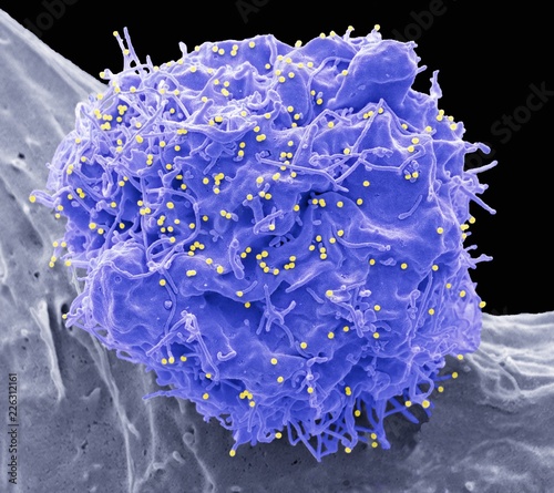 HIV infected cell, SEM photo