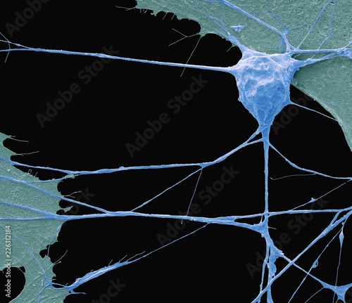 Stem cell-derived motor neuron, SEM photo