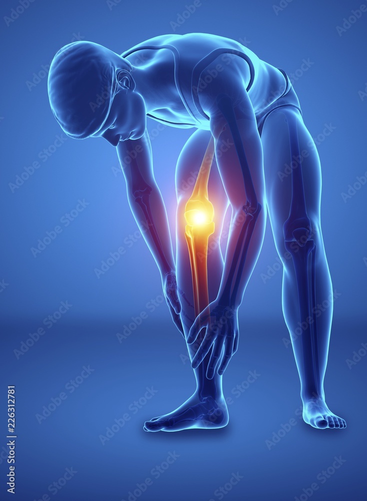 Man with knee pain, illustration Man with knee pain, illustration