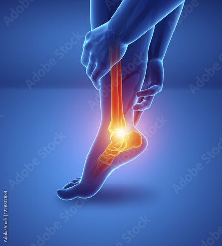 Man with foot pain, illustration photo