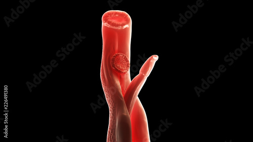 3d rendered medically accurate illustration of a schistosoma photo