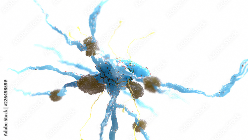 Fototapeta premium 3d rendered medically accurate illustration of amyloid plaques on a nerve cell - alzheimer disease
