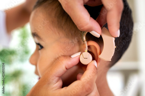 Helping little child to hear sound again