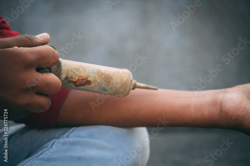 Man having injection in his hand