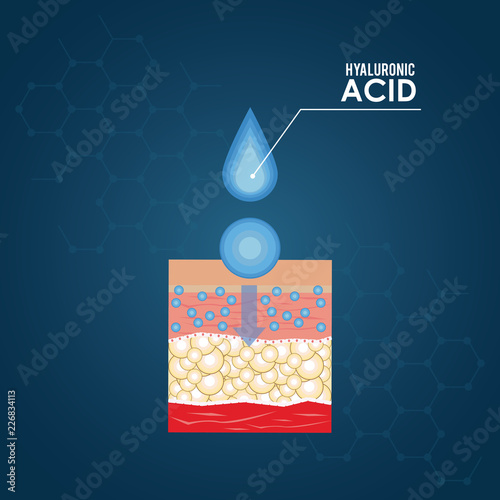 hyaluronic acid filler injection infographic