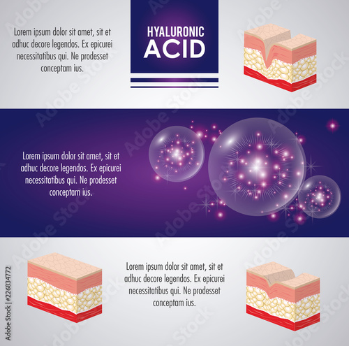 hyaluronic acid filler injection infographic