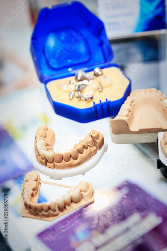 various samples of casts of dentures, close up