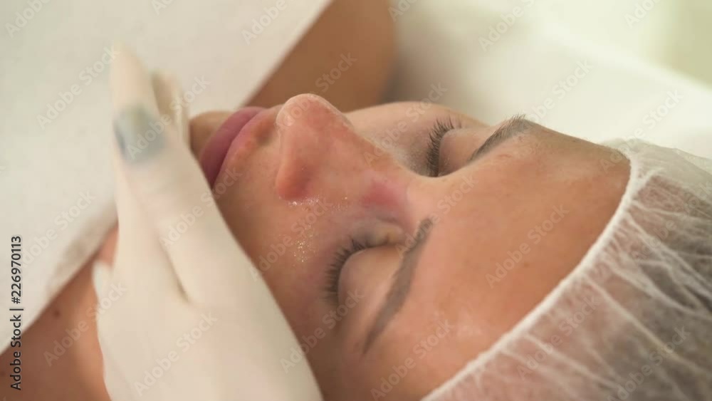 A top view of a woman's face after cleansing and mask application. A hand in a white rubber glove applies some gel on the face in strokes.