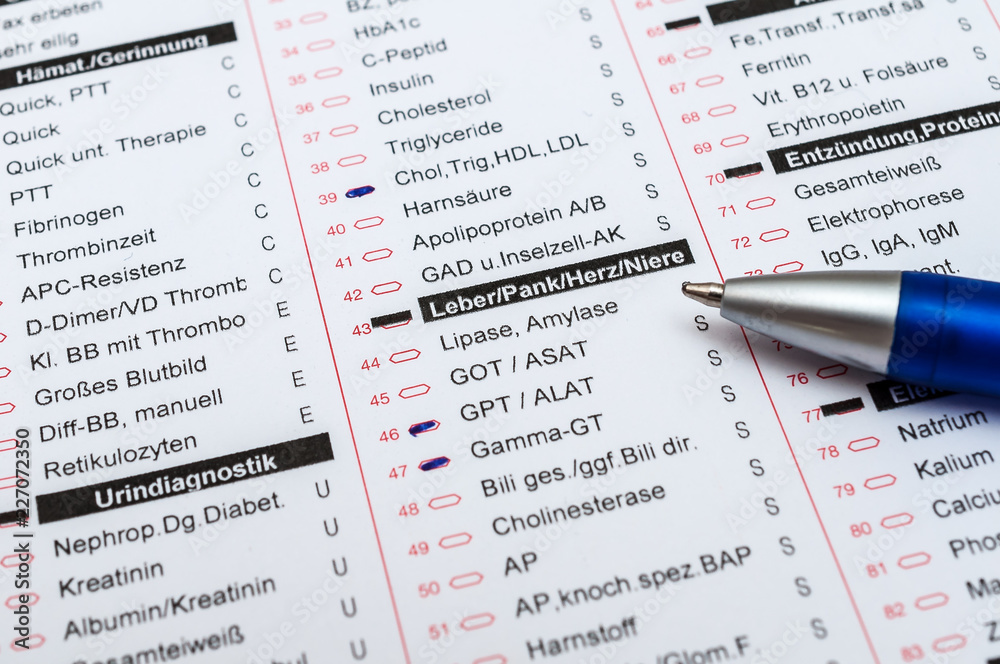 Fototapeta premium Blutuntersuchung im Labor