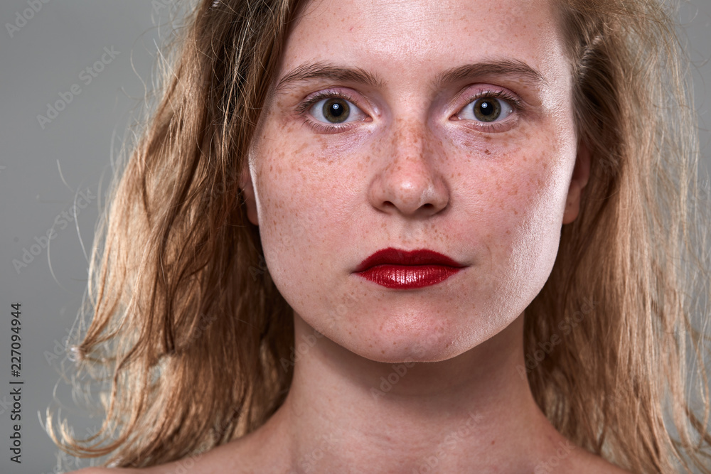 Young woman with freckles Young woman with freckles