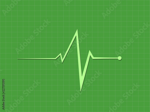 A green heart beat sign displaying in cardiograph monitor to diagnosis heart condition in hospital bed vector illustration