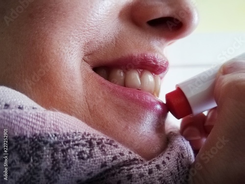 Woman puts lip balm