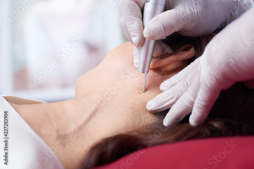 Close-up of female face with doctor in protective gloves doing cosmetology procedure