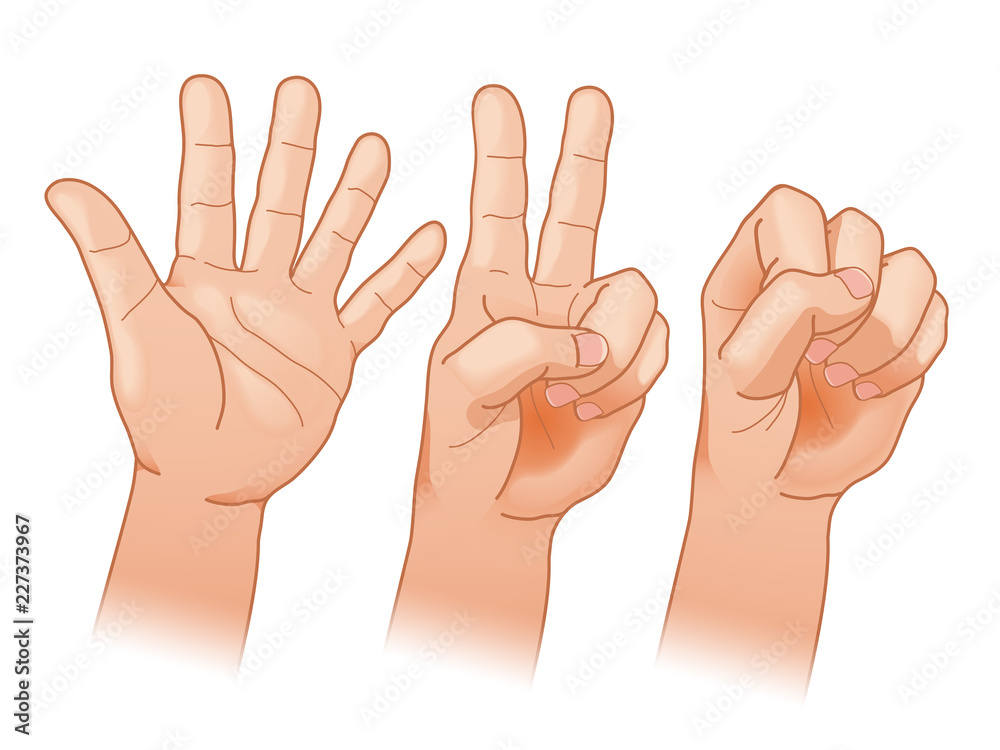 じゃんけんをする手 Stock イラスト Adobe Stock