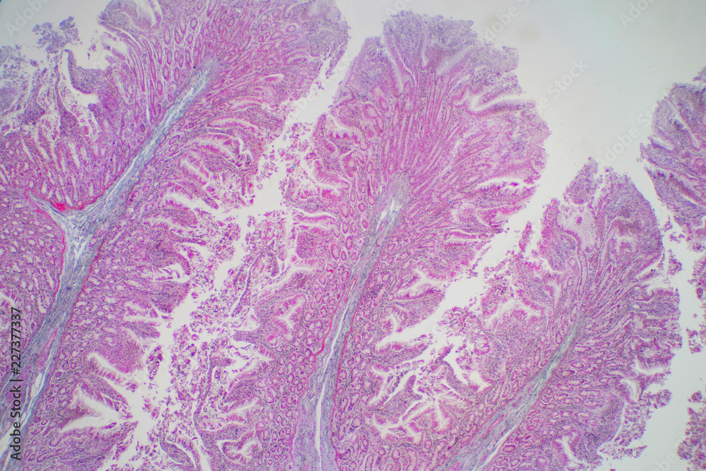 Integumet Under Microscope Photo & Art Print Human large intestine tissue under microscope view ...