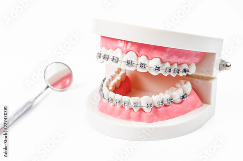 tooth model with metal wire dental braces and mirror dental equipment.