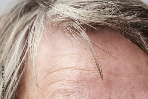 Elderly pensioner female, forehead closeup.