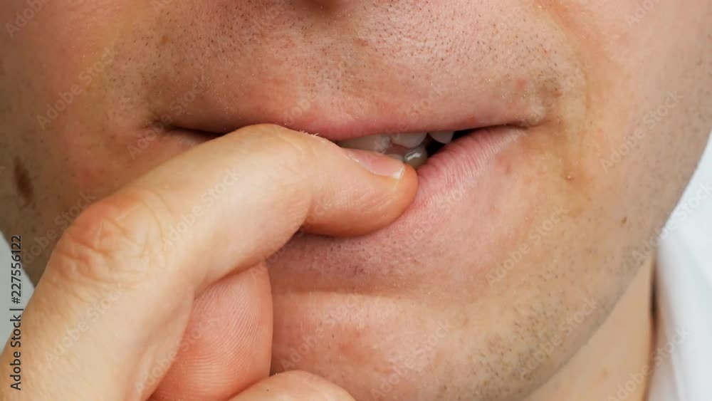man by teeth eats his nail on finger, close up, human problem man by teeth eats his nail on finger, close up, human problem