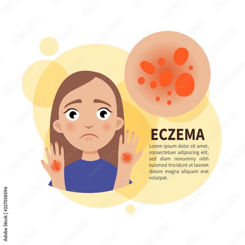 Vector poster. Eczema. Sad cute girl. Disease of the skin. Stock Vector