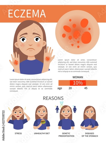 Infographics of eczema. Skin problems. Illustration of a cute girl. Causes of the appearance of the disease.