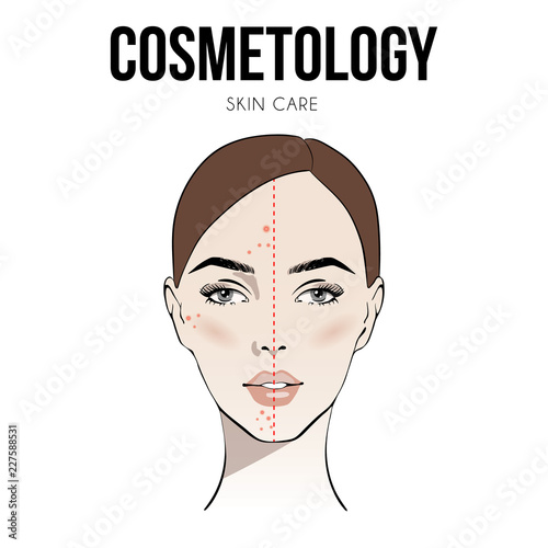 Beautiful woman face with Acne skin problems before and after vector illustration. Skin care. Cosmetology. Perfect skin. Beautiful portrait young girl, Sketch. Vector illustration. Spa beauty concept