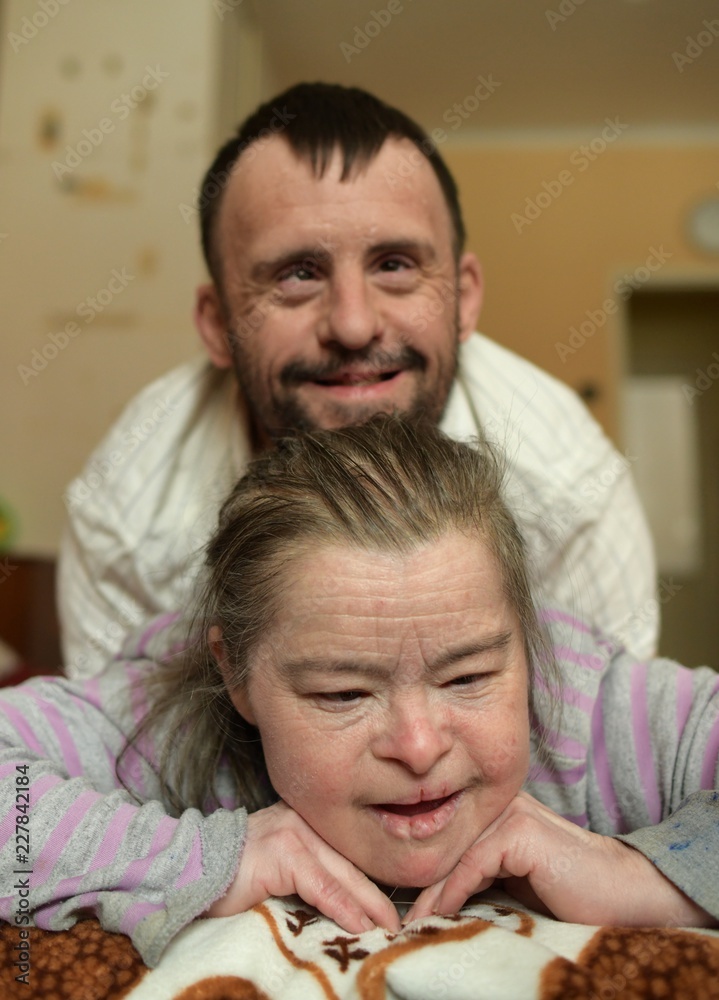love couple with down syndrome