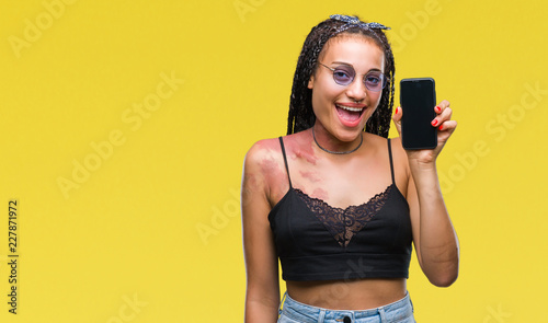 Young braided hair african american with birth mark showing smartphone screen over isolated background with a happy face standing and smiling with a confident smile showing teeth