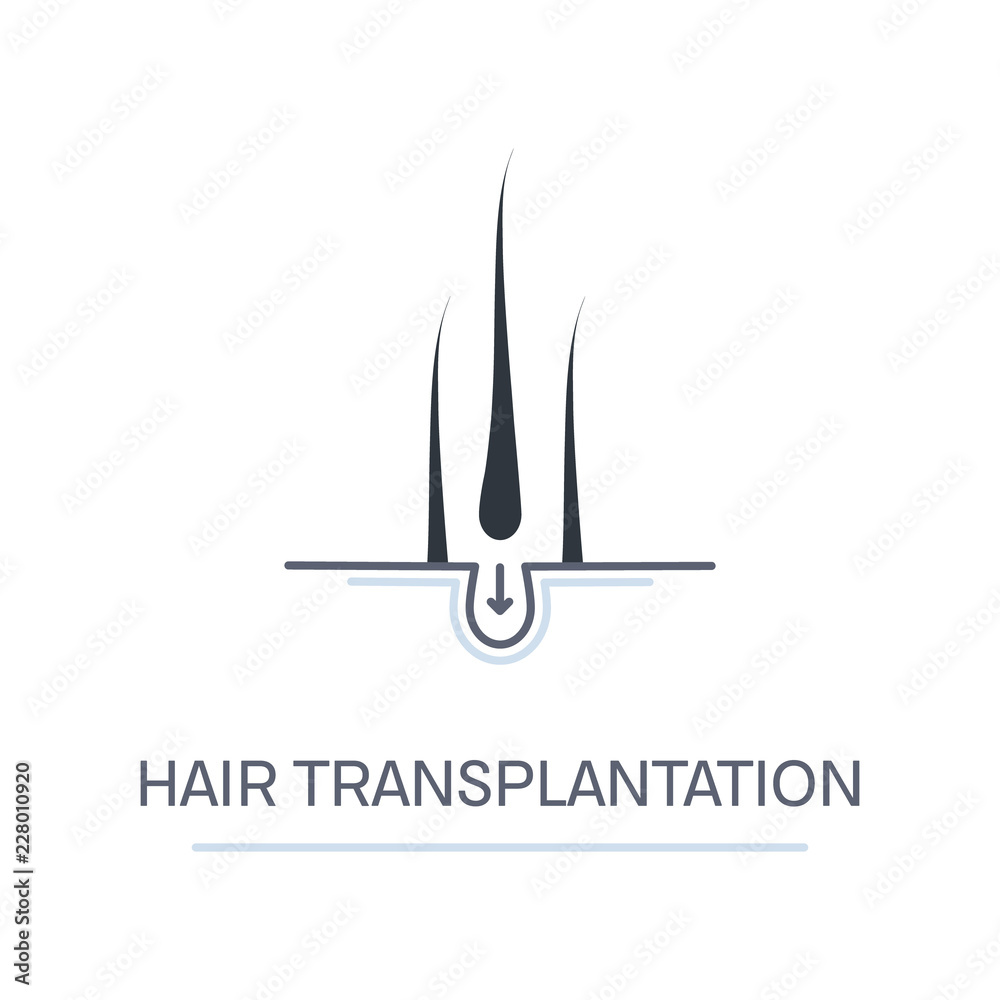 Hair transplantation logo template with three follicles. Hair restoration concept. Alopecia medical design for clinics and diagnostic centers. Hair transplantation logo template with three follicles. Hair restoration concept. Alopecia medical design for clinics and diagnostic centers.