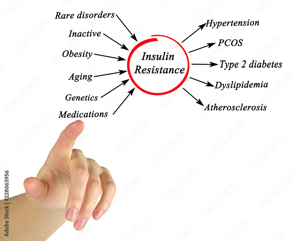 Causes and effects of Insulin Resistance Causes and effects of Insulin Resistance