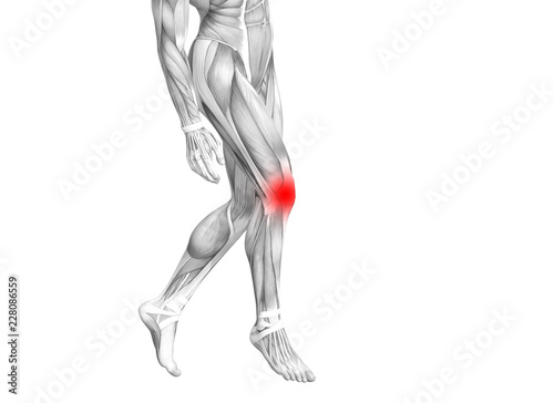 Fototapeta Naklejka Na Ścianę i Meble -  Conceptual knee human anatomy with red hot spot inflammation or articular joint pain for leg health care therapy or sport muscle concepts. 3D illustration man arthritis or bone osteoporosis disease