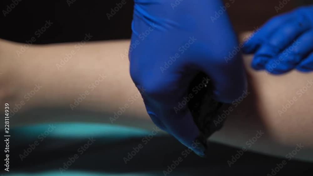 A sugaring is performed using the black paste from the legs of a young woman at a spa. The master molds a ball against the direction of hair growth and pulls the hair in the direction of growth. A sugaring is performed using the black paste from the legs of a young woman at a spa. The master molds a ball against the direction of hair growth and pulls the hair in the direction of growth.