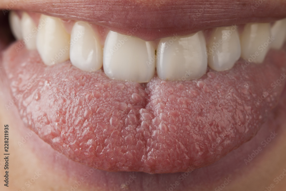 Obraz premium Lengua y dientes