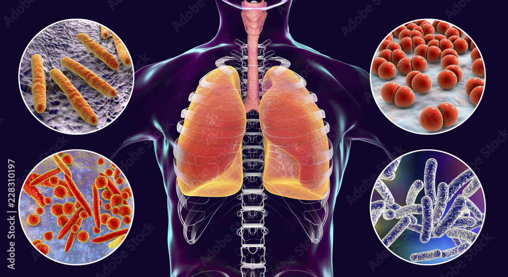 Human respiratory pathogens, 3D illustration. Mycobacterium ...