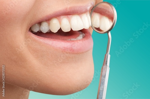 Woman teeth and a dentist mouth mirror