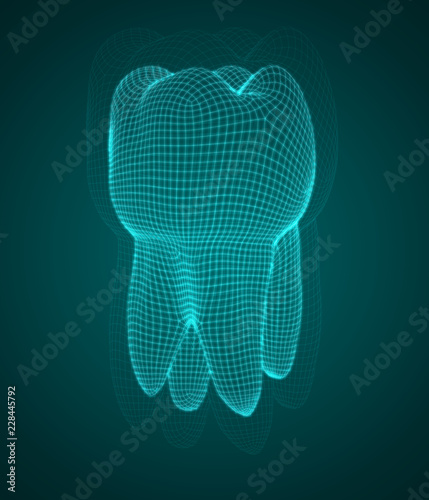 vector 3d tooth for dental medicine. on a blue background