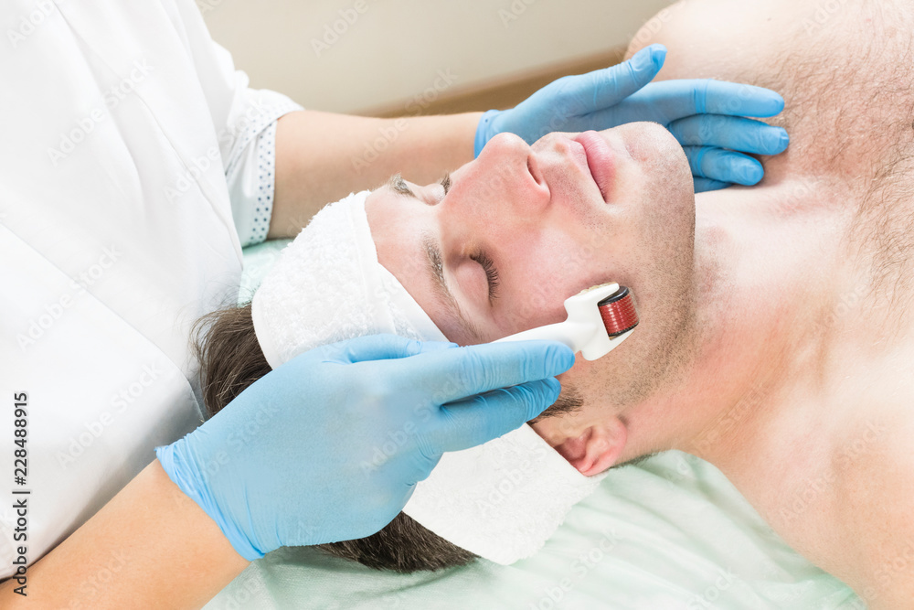 The man undergoes the procedure of medical micro needle therapy with a modern medical instrument derma roller. The man undergoes the procedure of medical micro needle therapy with a modern medical instrument derma roller.