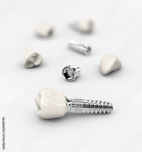 Dental implant on the white background, 3d illustration